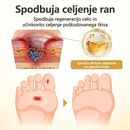 Mickey® GlucaVeil 24H zaščitni sprej za stopala