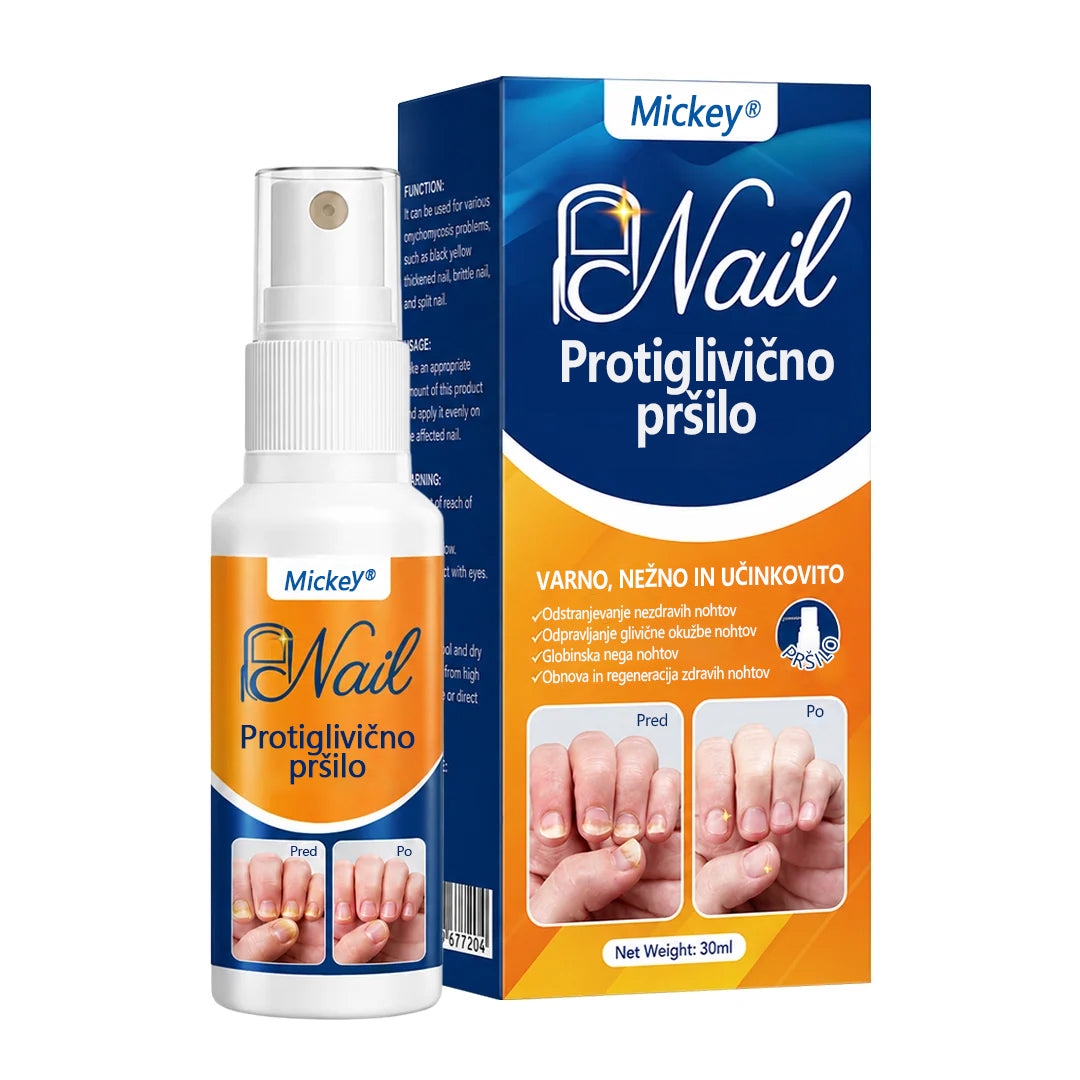 Mickey® pršilo za lajšanje glivic na nohtih