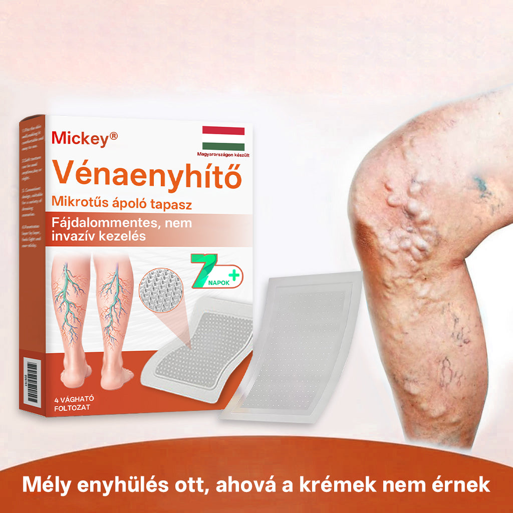 🎁 Mickey® Vein Ease Mikrotű Ápoló Tapasz (Pókvénák, visszér, duzzanat és lábfáradtság ellen) – Utolsó nap! 50% kedvezmény