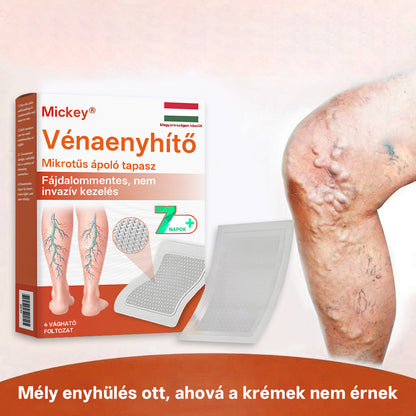 🎁 Mickey® Vein Ease Mikrotű Ápoló Tapasz (Pókvénák, visszér, duzzanat és lábfáradtság ellen) – Utolsó nap! 50% kedvezmény