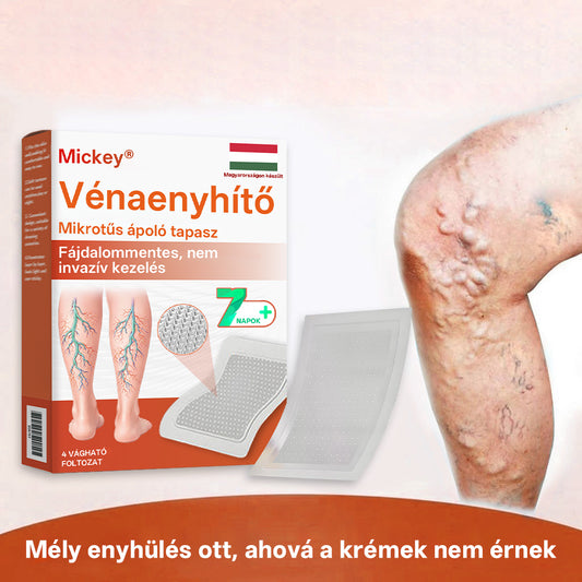 🎁 Mickey® Vein Ease Mikrotű Ápoló Tapasz (Pókvénák, visszér, duzzanat és lábfáradtság ellen) – Utolsó nap! 50% kedvezmény