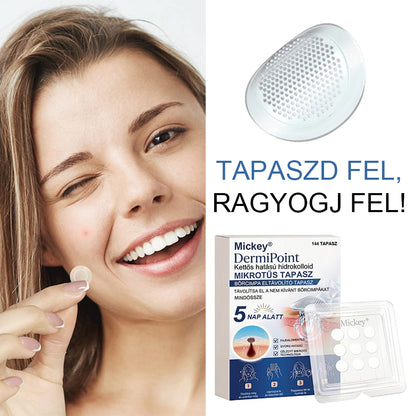 Mickey® DermiPoint Kettős hatású hidrokolloid mikrotűs tapasz🫘