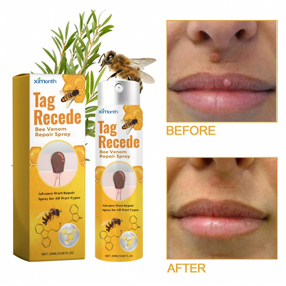 🐝Mickey®Méhméreges Szemölcstelenítő és Bőrregeneráló Spray