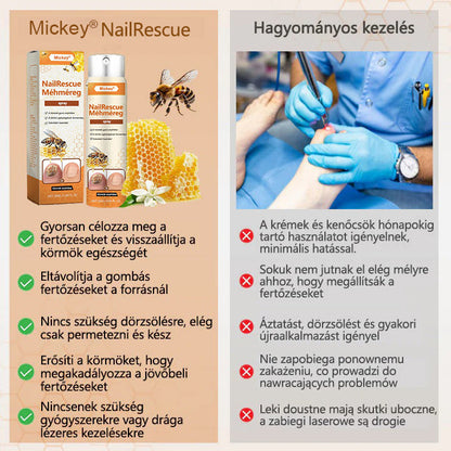 🐝🐝Mickey® NailRescue méhméreg spray