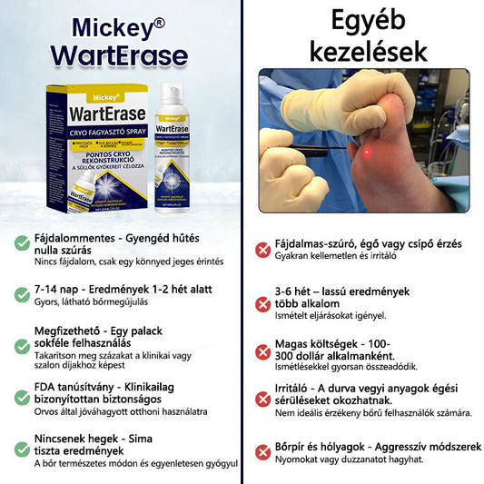 Mickey®WartErase – Fagyasztó Szemölcseltávolító Spray❄️