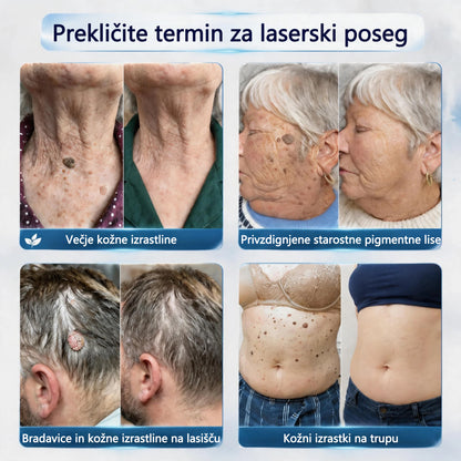 Mickey® Krema za izravnavo nepravilnosti na koži