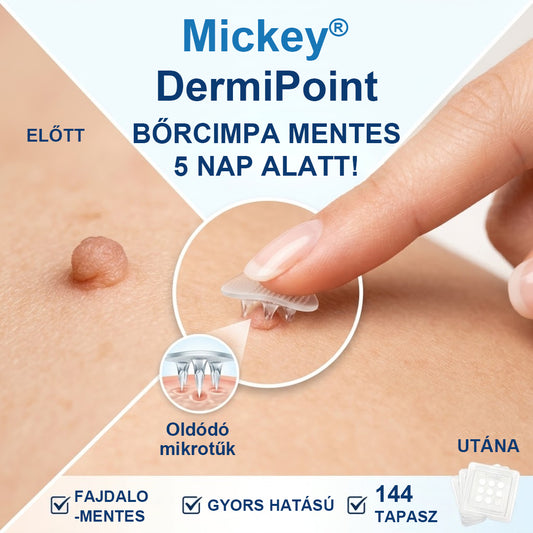 Mickey® DermiPoint Kettős hatású hidrokolloid mikrotűs tapasz🫘