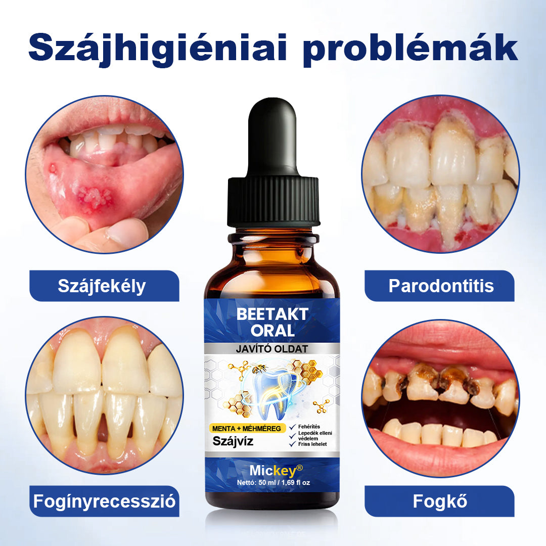 Mickey® BeeTakt szájápoló oldat💧💧