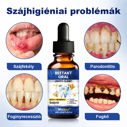 Mickey® BeeTakt szájápoló oldat💧