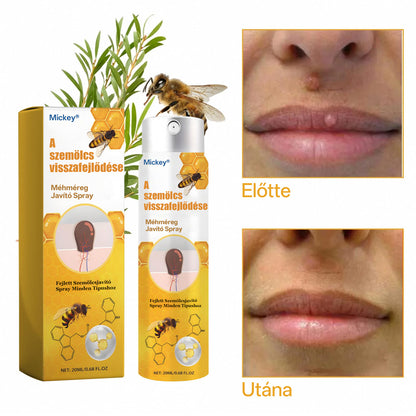 🐝🐝🐝Mickey®Méhméreges Szemölcstelenítő és Bőrregeneráló Spray
