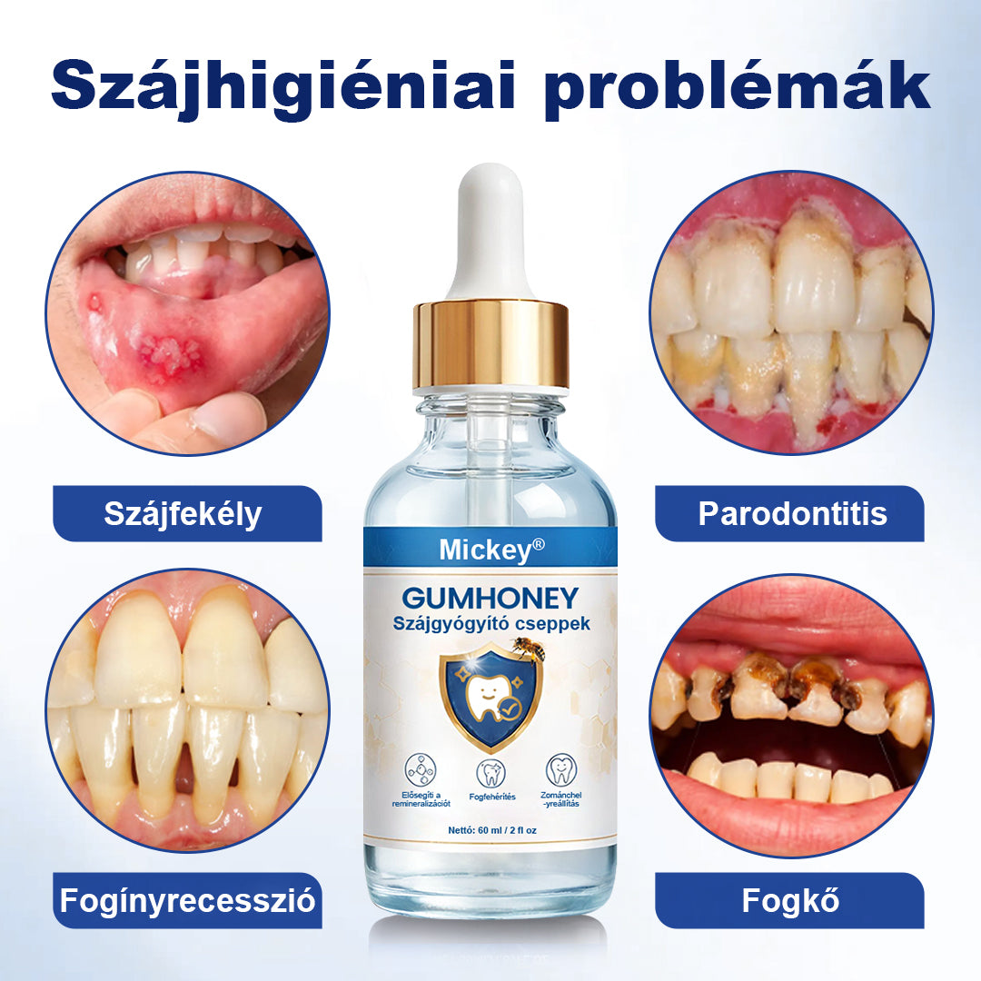 ☄️Mickey® GumHony szájüregi helyreállító cseppek