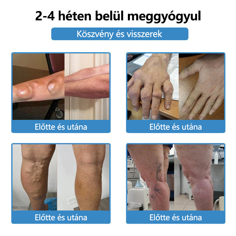 🛡️Mickey® Nano-tűs közös tapasz