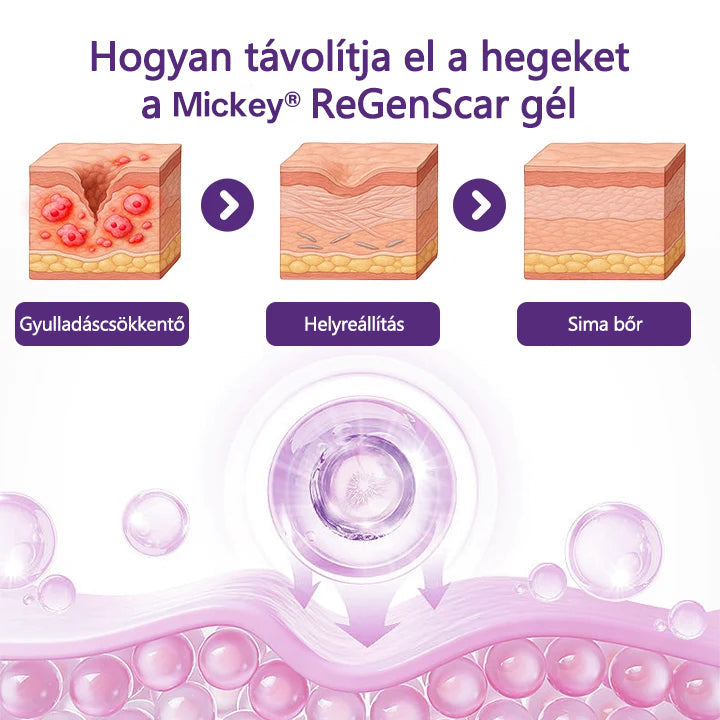Mickey® ReGenScar Őssejtes hegkezelő gél