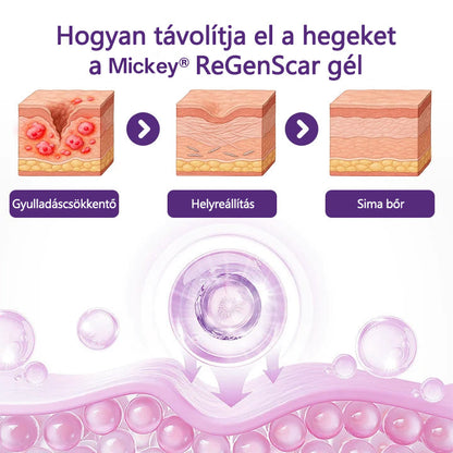 Mickey® ReGenScar Őssejtes hegkezelő gél