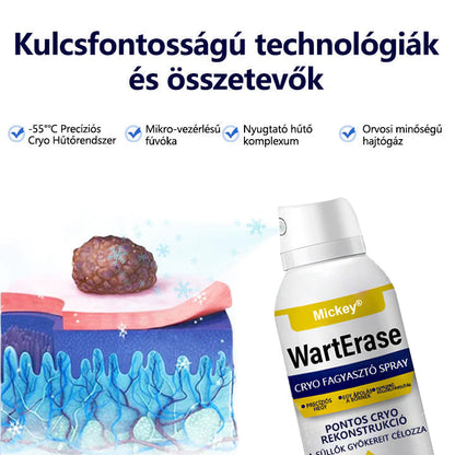 Mickey®WartErase – Fagyasztó Szemölcseltávolító Spray❄️