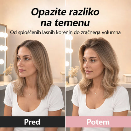 Mickey® sponka za dvig korenin las 🔥 Visok vrh glave v 3 sekundah!