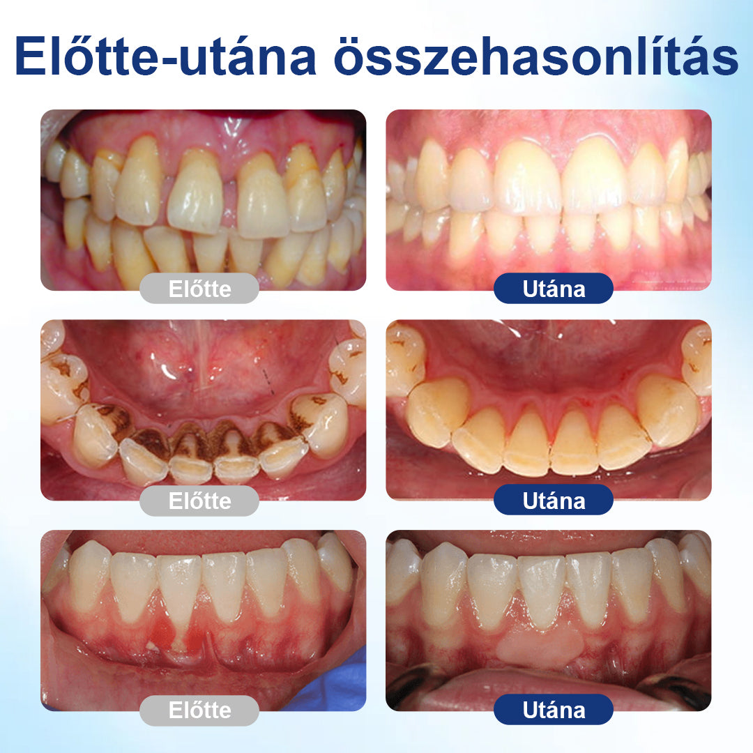 Mickey® BeeTakt szájápoló oldat💧💧