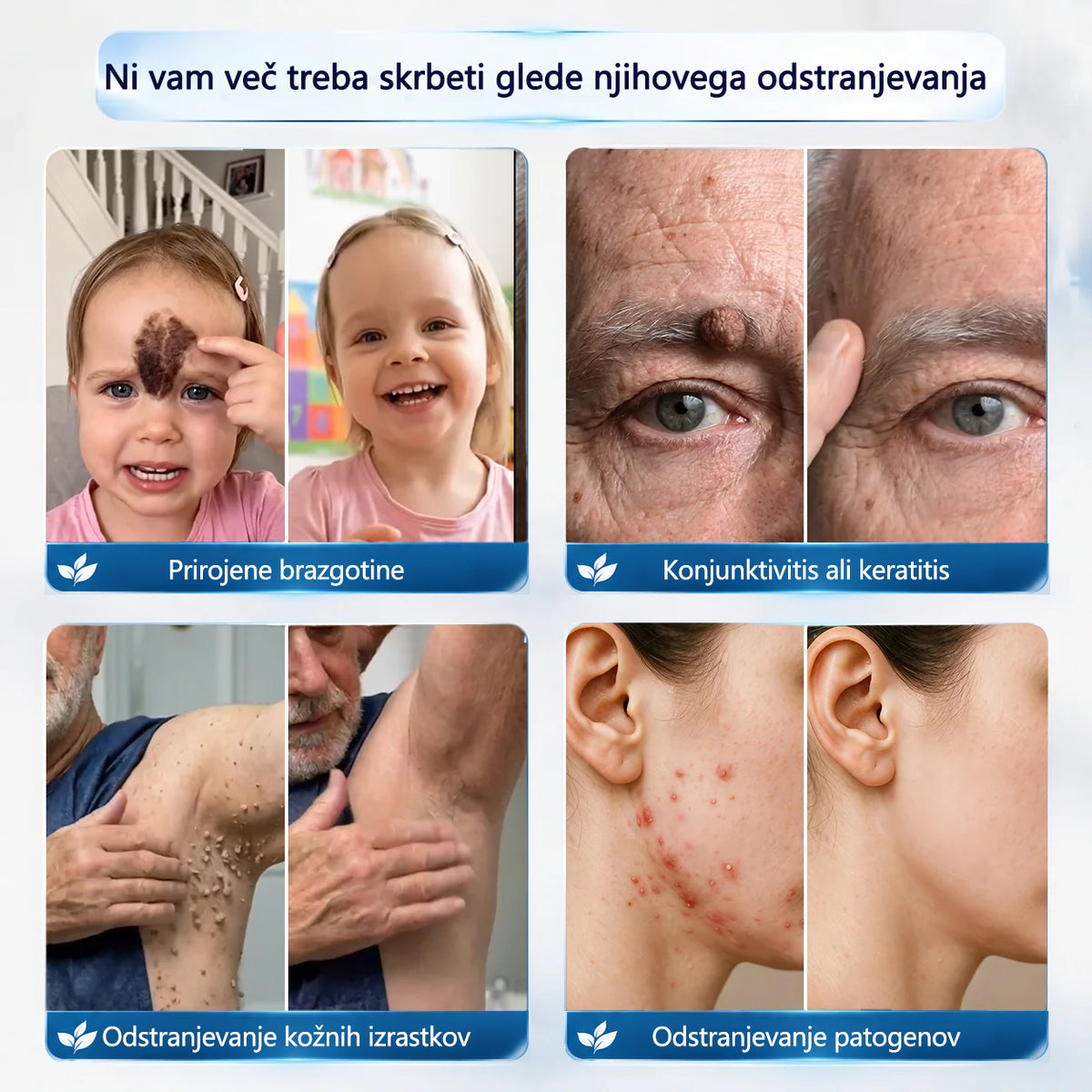 Mickey® Krema za izravnavo nepravilnosti na koži