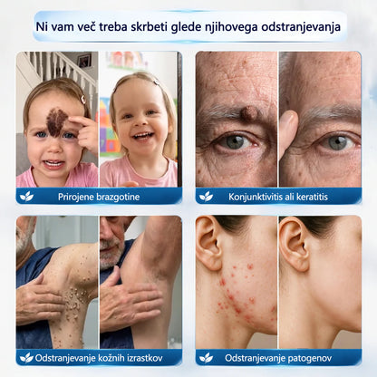 Mickey® Krema za izravnavo nepravilnosti na koži