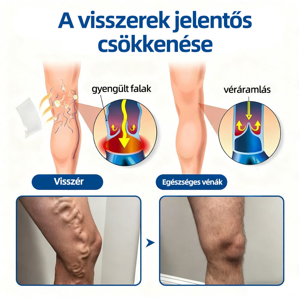 🏅Mickey®VeinTarget mikrotűs tapasz