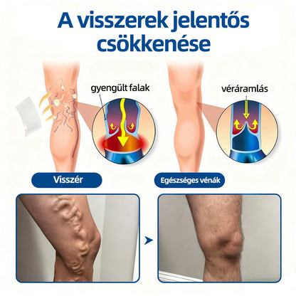 🏅Mickey®VeinTarget mikrotűs tapasz