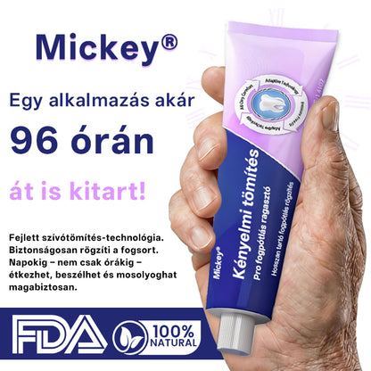 Mickey® Comfort Seal Pro fogsorragasztó🦷