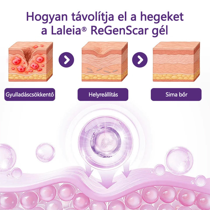 Laleia® ReGenScar Őssejtes hegkezelő gél