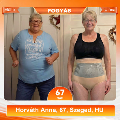 Mickey® 2026 Moringa & Berberine 4 az 1-ben Mikrorészecskés Formáló és Zsírégető Rövidnadrág💪