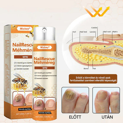 🐝🐝Mickey® NailRescue méhméreg spray