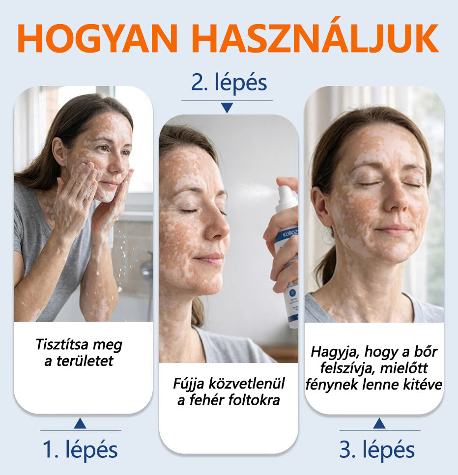 ⛰️Mickey® Piperine Repigment Aktivátor Spray