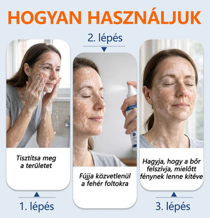 ⛰️Mickey® Piperine Repigment Aktivátor Spray