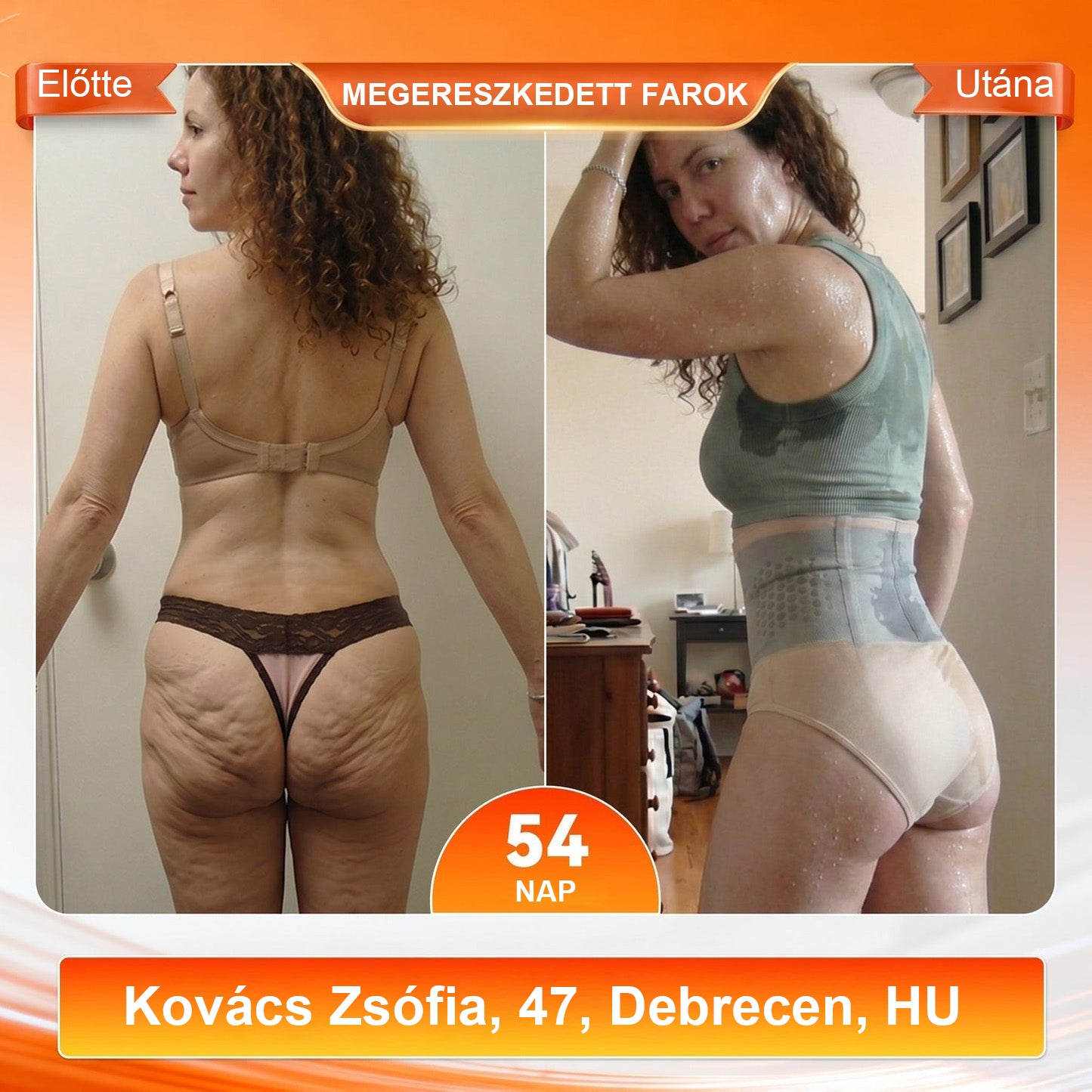 Mickey® 2026 Moringa & Berberine 4 az 1-ben Mikrorészecskés Formáló és Zsírégető Rövidnadrág💪