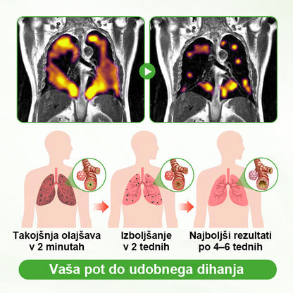 Uradna trgovina blagovne znamke✅ Mickey® HerbaAir Mullein čiščenje pljuč