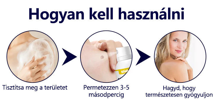 Mickey®WartErase – Fagyasztó Szemölcseltávolító Spray❄️