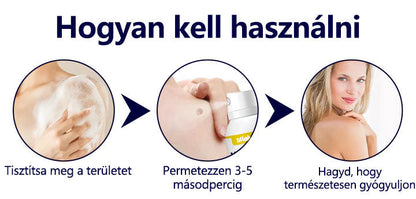 Mickey®WartErase – Fagyasztó Szemölcseltávolító Spray❄️
