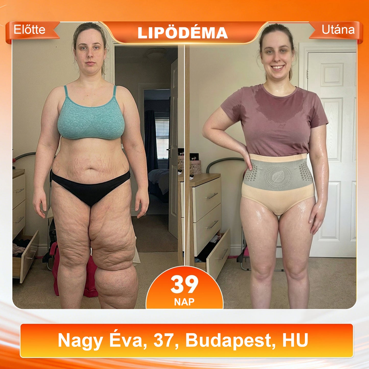 Mickey® 2026 Moringa & Berberine 4 az 1-ben Mikrorészecskés Formáló és Zsírégető Rövidnadrág💪