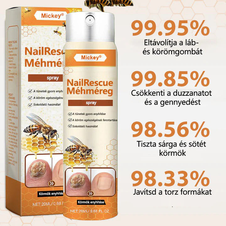 🐝🐝Mickey® NailRescue méhméreg spray