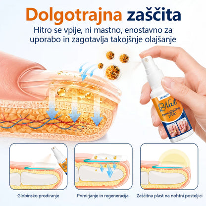 Mickey® pršilo za lajšanje glivic na nohtih