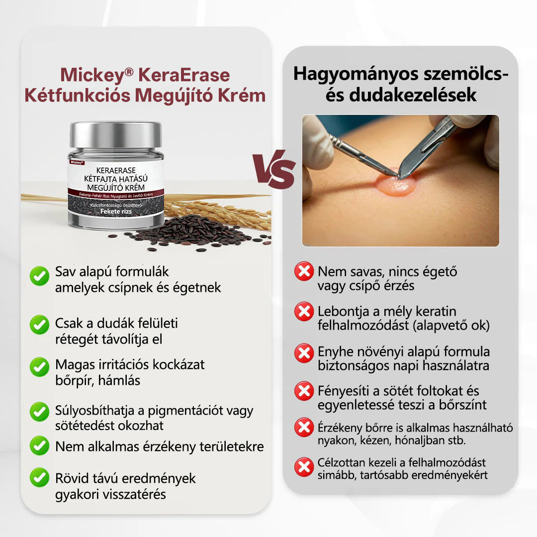 🔥Mickey®KeraErase kettős hatású megújító krém
