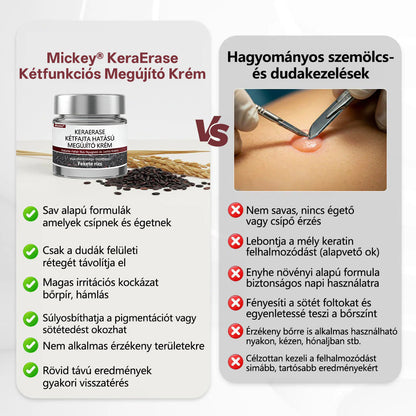 🔥Mickey®KeraErase kettős hatású megújító krém