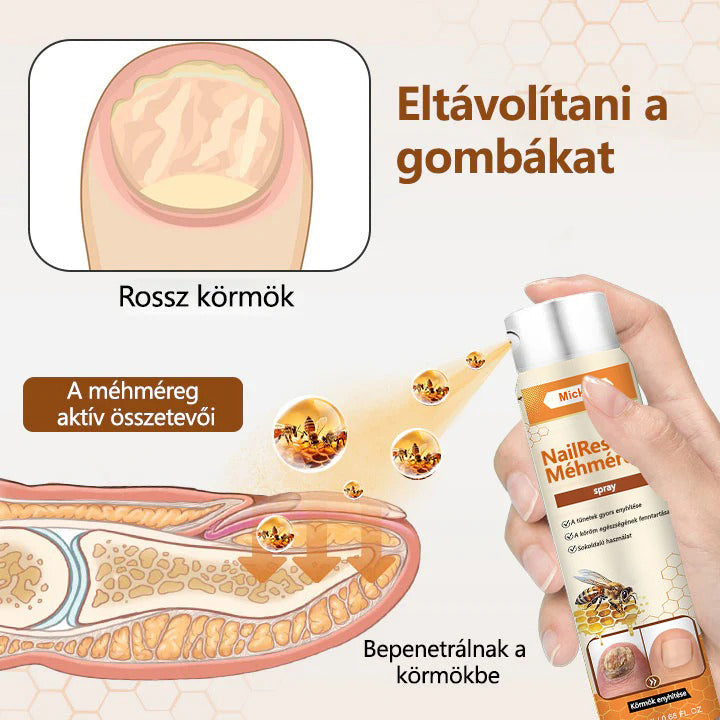 🐝🐝Mickey® NailRescue méhméreg spray