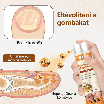 🐝🐝Mickey® NailRescue méhméreg spray
