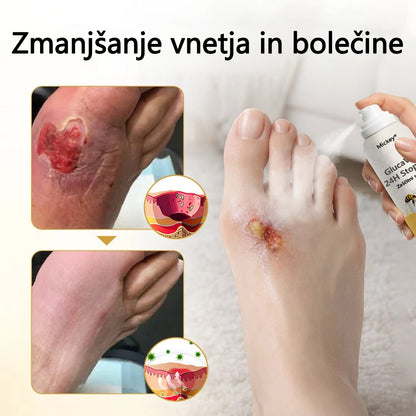 Mickey® GlucaVeil 24H zaščitni sprej za stopala