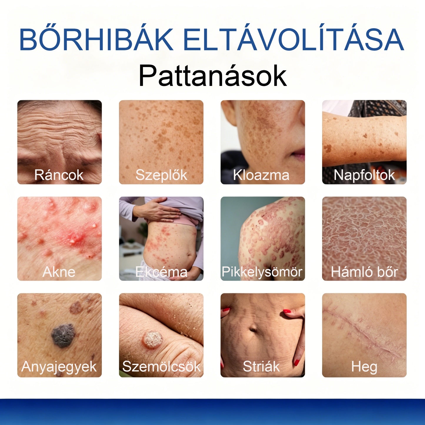Mickey® DermiPoint Kettős hatású hidrokolloid mikrotűs tapasz🫘
