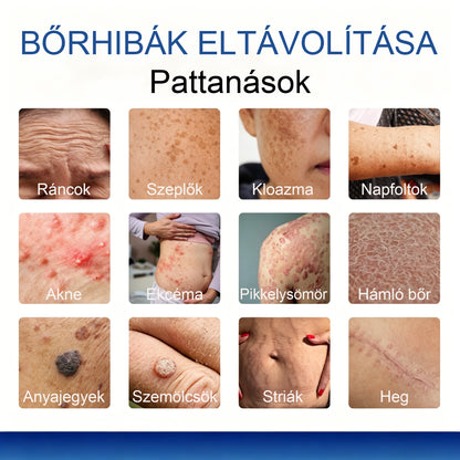 Mickey® DermiPoint Kettős hatású hidrokolloid mikrotűs tapasz🫘