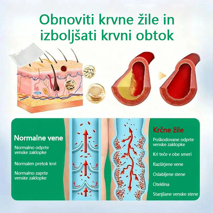 Mickey® VeinEase obliž z mikroiglami ⚡ Dolgotrajno izboljšanje