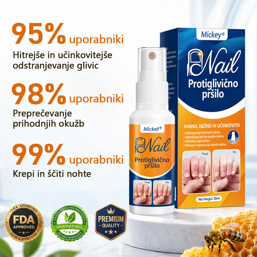 Mickey® pršilo za lajšanje glivic na nohtih