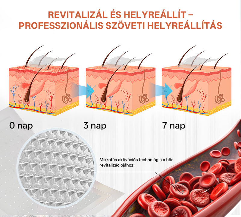 🎁 Mickey® Vein Ease Mikrotű Ápoló Tapasz (Pókvénák, visszér, duzzanat és lábfáradtság ellen) – Utolsó nap! 50% kedvezmény