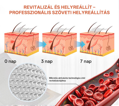 🎁 Mickey® Vein Ease Mikrotű Ápoló Tapasz (Pókvénák, visszér, duzzanat és lábfáradtság ellen) – Utolsó nap! 50% kedvezmény