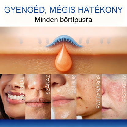Mickey® DermiPoint Kettős hatású hidrokolloid mikrotűs tapasz🫘